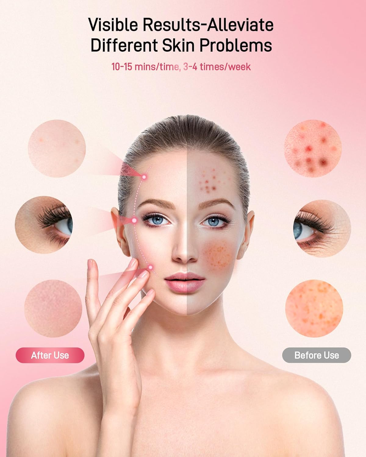 Zelvory PhotonMask – Maskë LED me Terapi Drite për Fytyrë